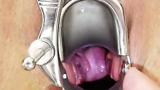 Big-breasted madam ob gyn exploration
